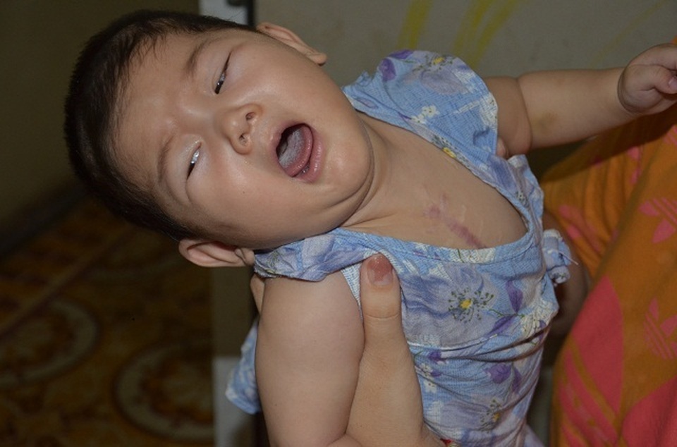 Bé gái mắc bệnh tim phức tạp tiếp tục được bạn đọc Dân trí giúp đỡ - 1 Bé gái mắc bệnh tim phức tạp tiếp tục được bạn đọc Dân trí giúp đỡ - 1