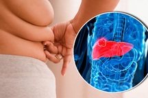 Vì sao người thừa cân, béo phì dễ mắc nhiều bệnh ung thư?