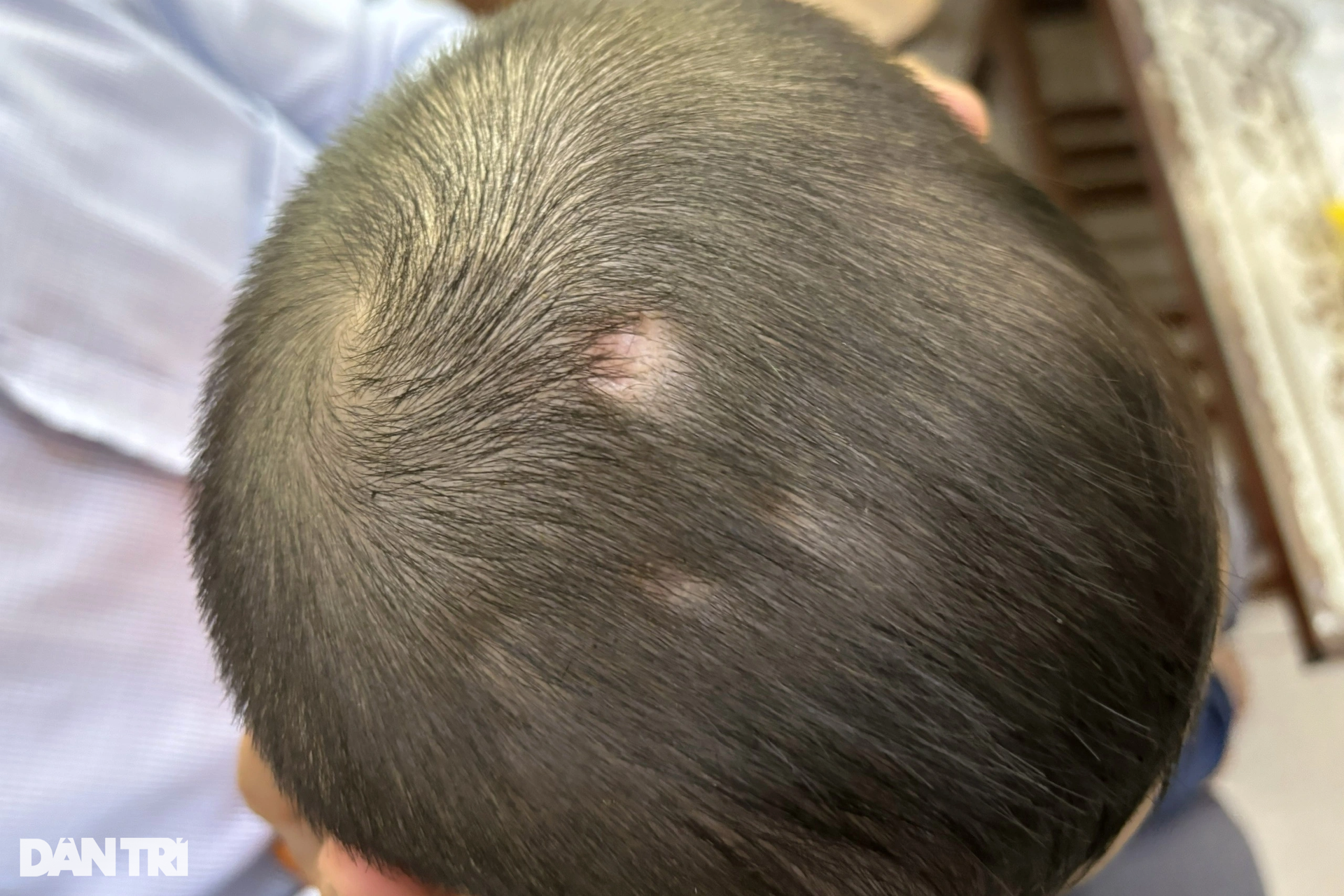 Cuộc sống mới của bé trai 3 tuổi bị tưới nước sôi, bạo hành ở TPHCM - 6 Cuộc sống mới của bé trai 3 tuổi bị tưới nước sôi, bạo hành ở TPHCM - 6