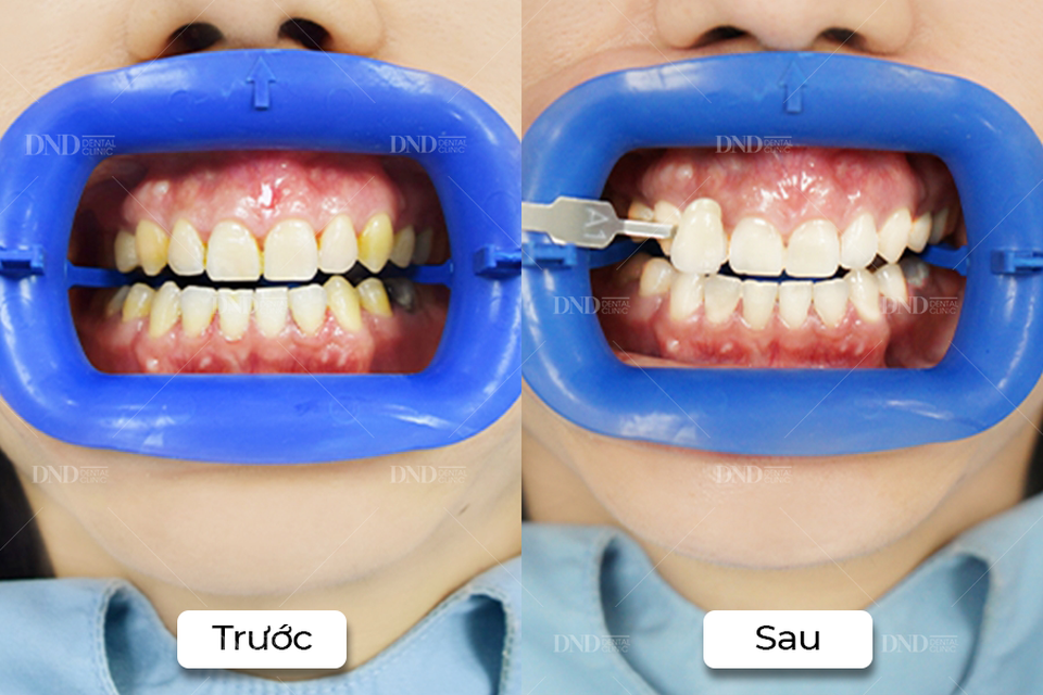 Dùng thưởng Tết đúng cách cho nụ cười với 3 gợi ý sau - 1 Dùng thưởng Tết đúng cách cho nụ cười với 3 gợi ý sau - 1