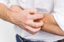 Người đàn ông gãi đến loét da vì cảm thấy... có con gì bò trên tay