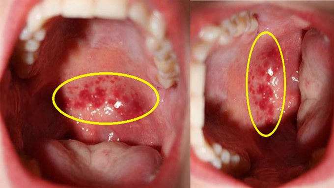 Ăn nhiều muối có thể gây bệnh, nhưng muối cũng là “dược liệu” tuyệt vời để chữa bệnh - Ảnh 5. Ăn nhiều muối có thể gây bệnh, nhưng muối cũng là “dược liệu” tuyệt vời để chữa bệnh - Ảnh 5.