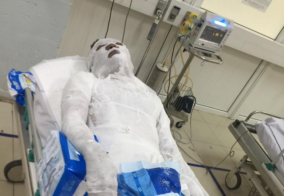 Tạm giữ nghi can vụ nam thanh niên bị tưới xăng, đốt giữa đường - 1 Tạm giữ nghi can vụ nam thanh niên bị tưới xăng, đốt giữa đường - 1