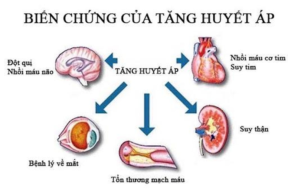 Máy đo huyết áp tại nhà giúp phát hiện sớm bệnh cao huyết áp - 2 Máy đo huyết áp tại nhà giúp phát hiện sớm bệnh cao huyết áp - 2