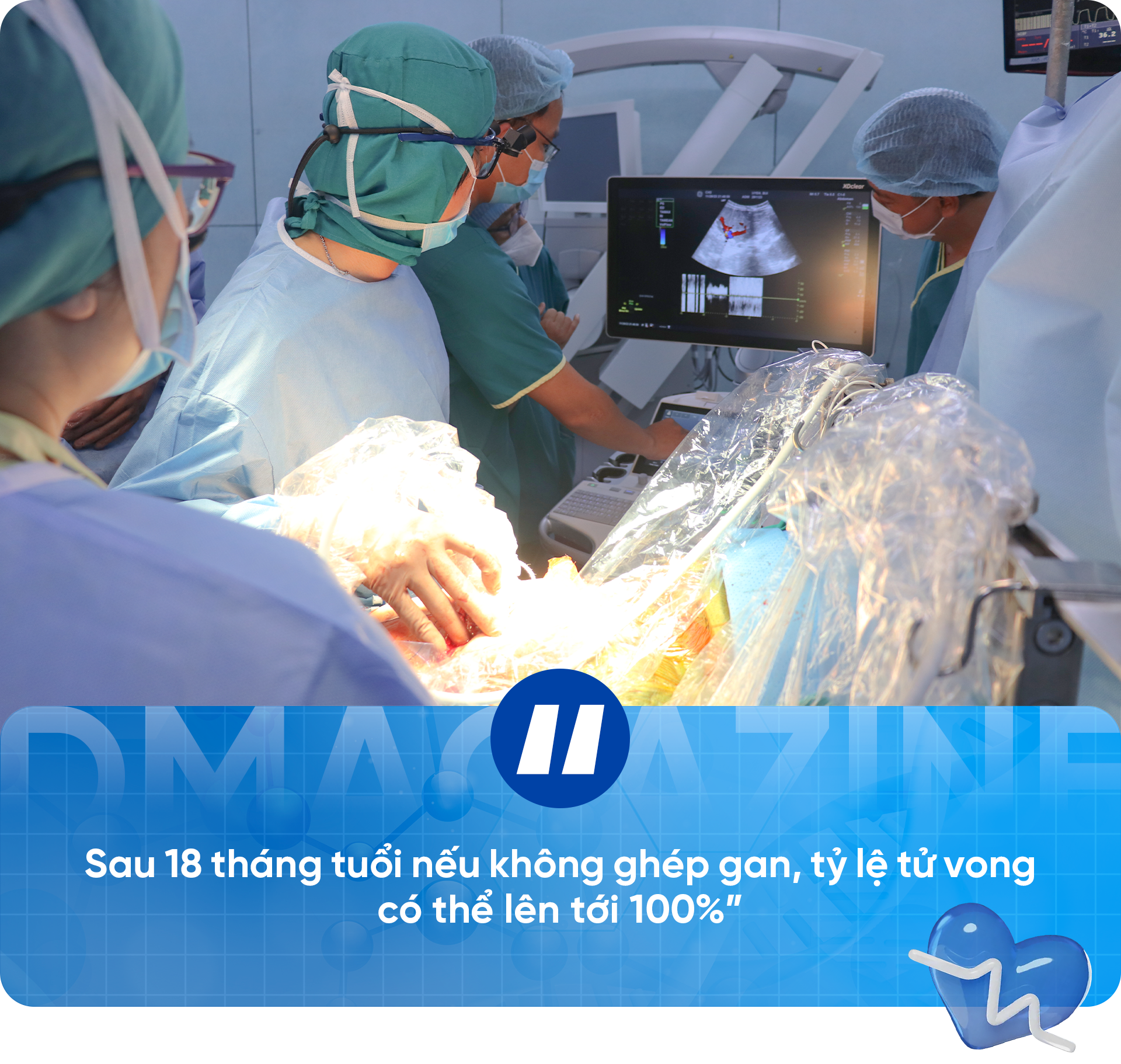 Hơn hai thập kỷ ghép tạng trẻ em: Viết tiếp những trang tuổi thơ dang dở - 3