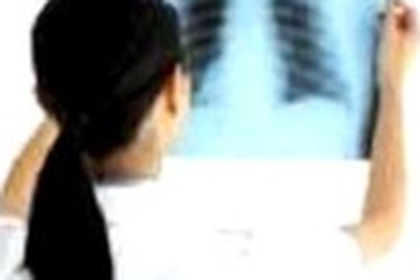 Mỗi năm có 3.000 bệnh nhân lao đa kháng thuốc