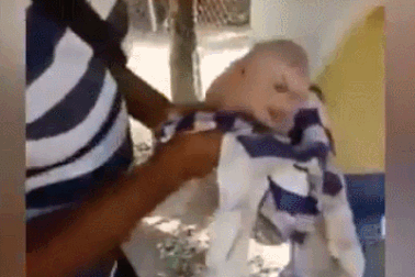 Xôn xao lợn đột biến có mặt như mặt người