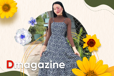 Cô giáo trẻ sống vui vẻ, tự tin với vết bớt chiếm một phần tư gương mặt