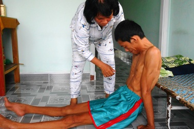 Bi kịch cả gia đình đều mắc bệnh teo rút chân tay