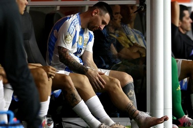 Chân của Messi biến dạng vì chấn thương ở trận chung kết Copa America