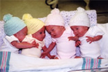 Một phụ nữ Ấn sinh tư cùng trứng