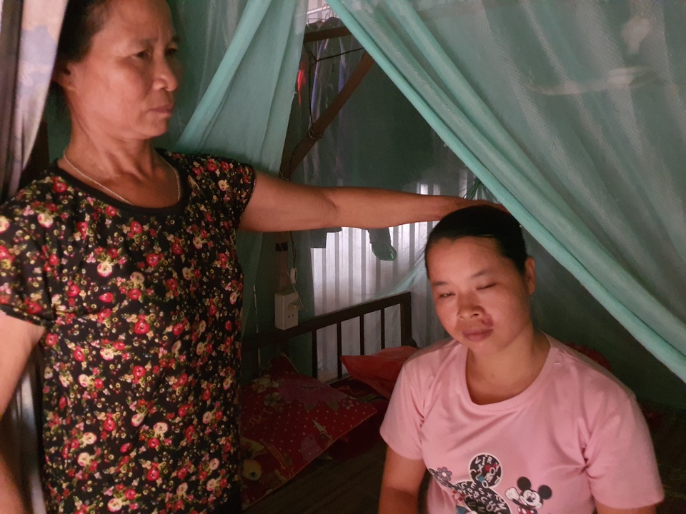 Thương gia đình nghèo lay lắt nuôi 3 đứa con cùng mang bệnh giống nhau - 3 Thương gia đình nghèo lay lắt nuôi 3 đứa con cùng mang bệnh giống nhau - 3