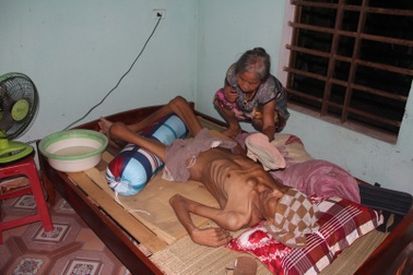 Tận cùng nỗi đau của người đàn ông đơn độc bị bệnh tật đọa đày gầy trơ xương