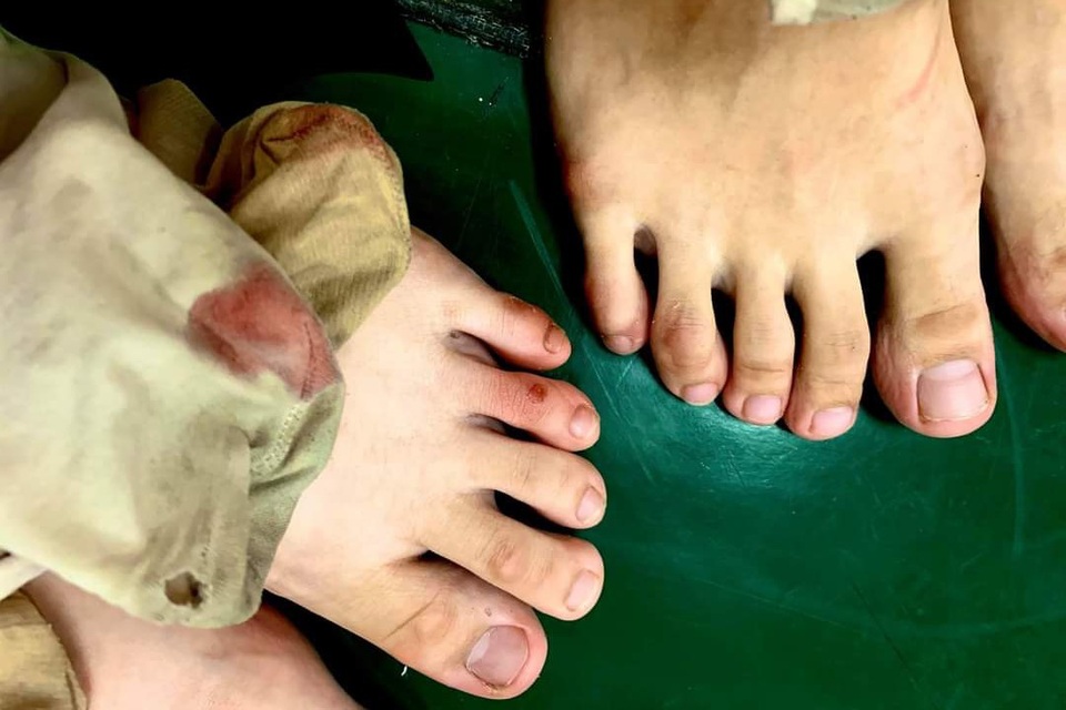 Đôi chân rướm máu và nước mắt gian khổ của học sinh trường Múa - 9 Đôi chân rướm máu và nước mắt gian khổ của học sinh trường Múa - 9