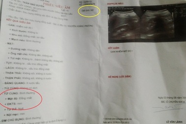 Vụ siêu âm thấy tử cung ở bệnh nhân nam: Do lỗi đánh máy!