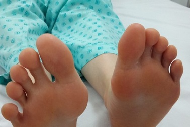 Giải pháp mới giúp điều trị tình trạng đổ mồ hôi chân