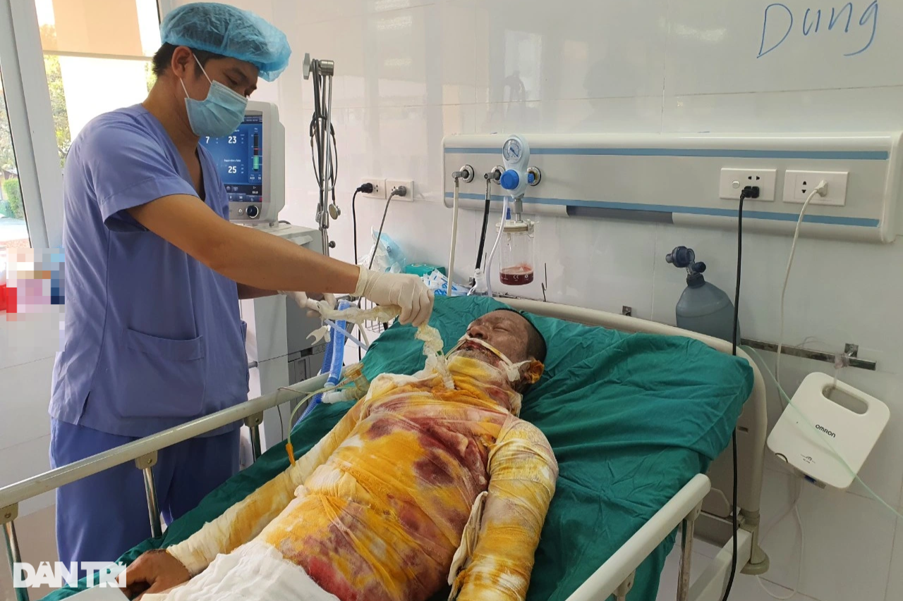 Bapa dalam keadaan kritikal akibat melecur elektrik, tidak dapat melihat muka bayi yang baru lahir - 2 Người cha nguy kịch vì bỏng điện, chưa kịp nhìn mặt con mới sinh - 2