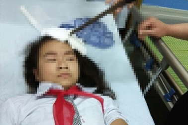 Bộ GD&ĐT yêu cầu xử lý nghiêm học sinh phi dao vào trán bạn