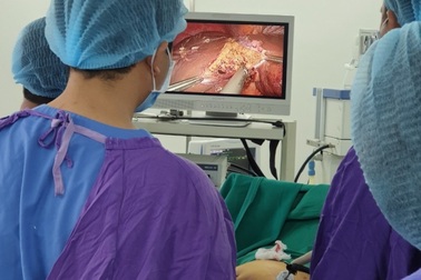 Nội soi cắt u gan cho nữ bệnh nhân 39 tuổi mắc ung thư gan
