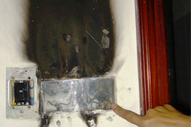 Bé 11 tuổi “tự cháy”: Khả năng đặc biệt hay... trò nghịch dại?