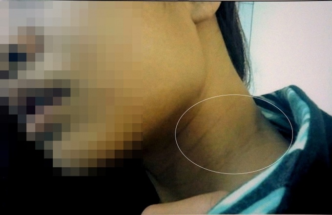 TP.HCM: Đại gia hiếp dâm em vợ hờ là nữ du học sinh Mỹ rồi bỏ trốn - Ảnh 2. TP.HCM: Đại gia hiếp dâm em vợ hờ là nữ du học sinh Mỹ rồi bỏ trốn - Ảnh 2.