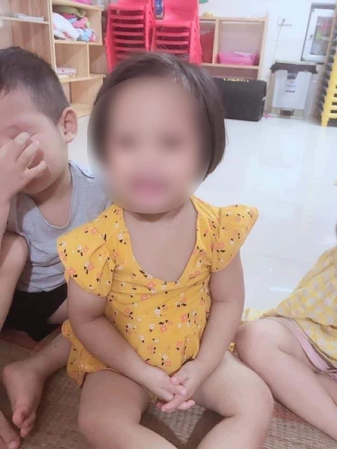 Bé gái đầy đinh trong đầu: Con trẻ sống dở, chết ngạt khi bố mẹ ly hôn! - 2 Bé gái đầy đinh trong đầu: Con trẻ sống dở, chết ngạt khi bố mẹ ly hôn! - 2