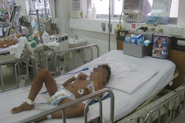 Bị dằm đâm vào chân, một bệnh nhi bị uốn ván nặng