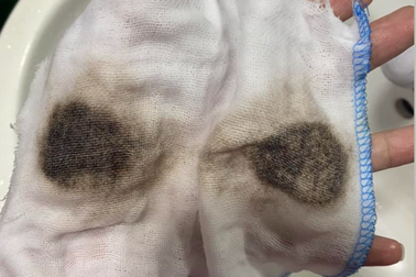 Khổ như sống chung cư Hà Nội: Nước cặn bẩn, nổi mẩn ngứa, đưa con về quê