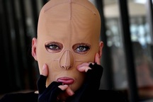 Cuộc sống hồi sinh của cô gái trải qua 200 cuộc phẫu thuật vì bị tạt axit