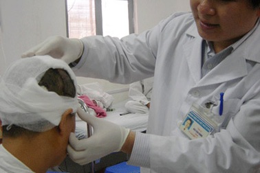 Những ca tai nạn “lột” da đầu hi hữu