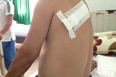 Nghi án Cựu chiến binh bị chém vì… mở nhạc to