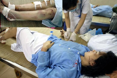 Dư luận lên án gay gắt vụ người chồng tra tấn vợ 