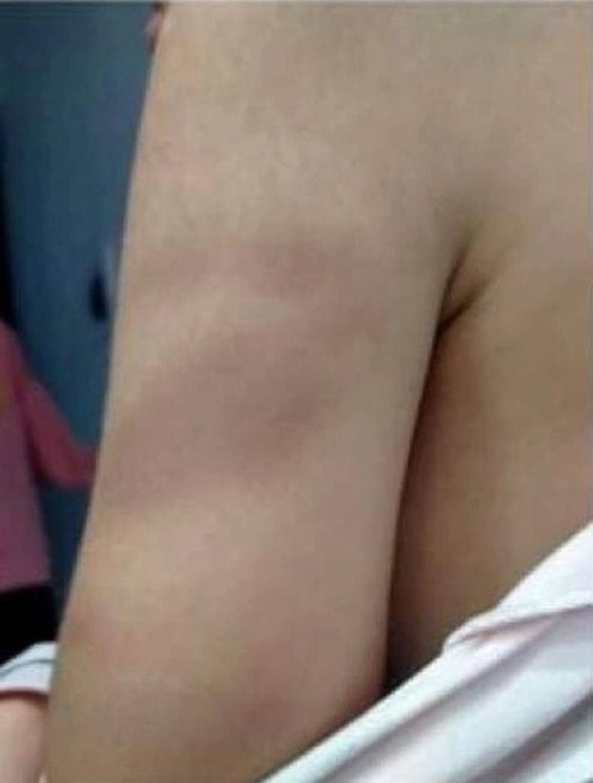 Làm rõ và xử lý nghiêm cô giáo tiểu học đánh tím tay, mông học sinh - 1 Làm rõ và xử lý nghiêm cô giáo tiểu học đánh tím tay, mông học sinh - 1