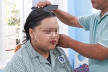 Cô gái béo phì ở TPHCM nguy kịch vì nhiễm vi khuẩn "nổi tiếng kháng thuốc"