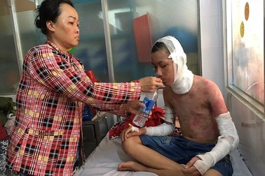 Hai học sinh bị bỏng cồn nặng khi đang học thí nghiệm