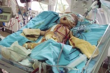 Bé 4 tháng tuổi chống chọi với bệnh tim hiểm nghèo