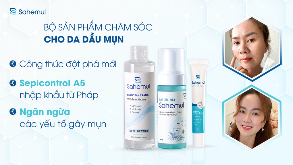 Sahemul ra mắt bộ 3 sản phẩm hỗ trợ làm sạch da, ngăn ngừa mụn - 1 Sahemul ra mắt bộ 3 sản phẩm hỗ trợ làm sạch da, ngăn ngừa mụn - 1