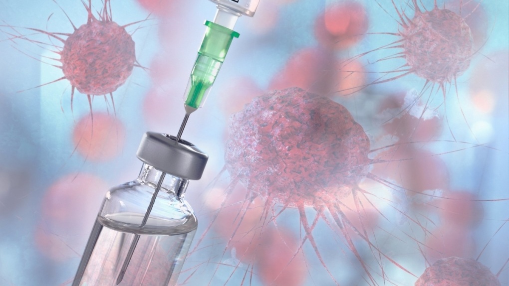 Chuyên gia kỳ vọng vaccine ung thư của Nga: Xóa án tử, thêm cơ hội sống - 3 Chuyên gia kỳ vọng vaccine ung thư của Nga: Xóa án tử, thêm cơ hội sống - 3