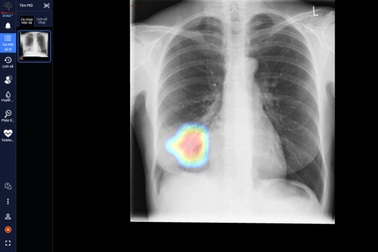 DrAid - công cụ sàng lọc và tiên lượng Covid-19 ứng dụng AI đầu tiên tại Việt Nam