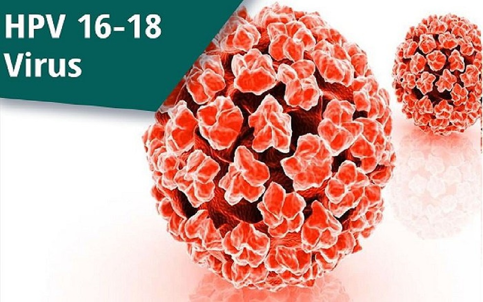 Nhiễm virus HPV có làm tăng ung thư cổ tử cung? - 1 Nhiễm virus HPV có làm tăng ung thư cổ tử cung? - 1