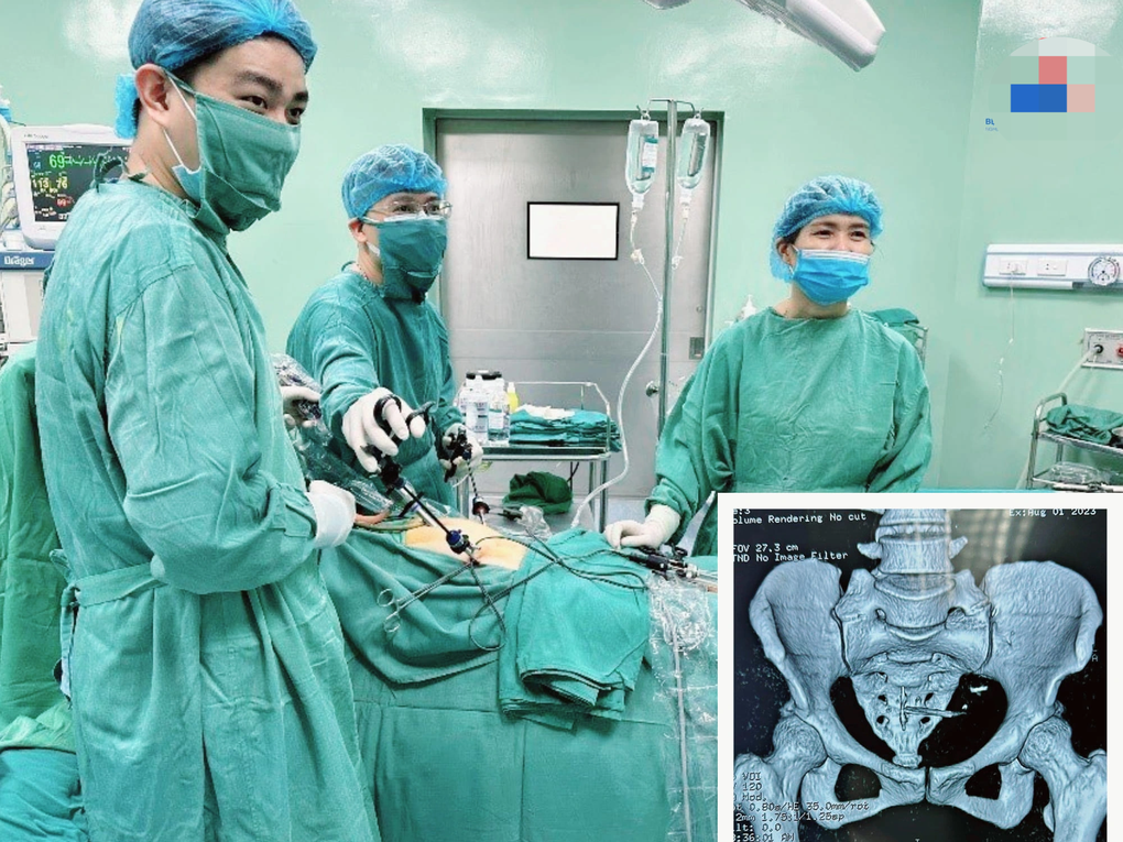 Vòng tránh thai đâm xuyên thành tử cung hai phụ nữ ở Nghệ An - 1 Vòng tránh thai đâm xuyên thành tử cung hai phụ nữ ở Nghệ An - 1