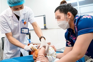 Bé trai 5 tháng tuổi bị loét đùi chỉ vì gia đình chủ quan
