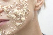 Trị mụn đầu đen hiệu quả với hỗn hợp này