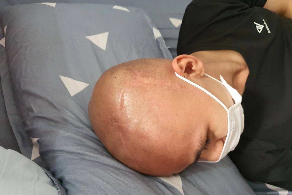 Xót xa cảnh chàng trai 15 tuổi, 3 lần phẫu thuật khẩn cầu sự giúp đỡ - 2 Xót xa cảnh chàng trai 15 tuổi, 3 lần phẫu thuật khẩn cầu sự giúp đỡ - 2