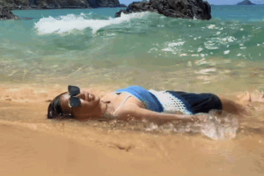 Mặc bikini "đu trend" ở biển, cô gái Hà Nội tìm bác sĩ sau chuyến du lịch