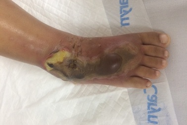 Bé gái 3 tuổi bị rắn hổ mang tấn công khi đang xem tivi