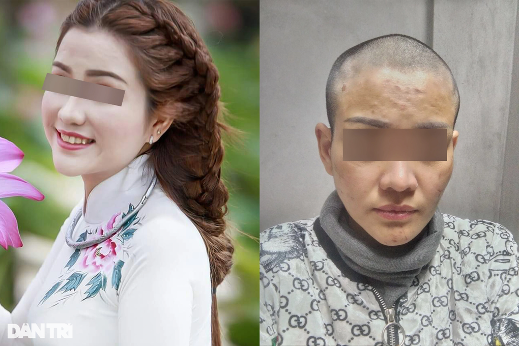 Thai phụ Kiên Giang bị chồng bạo hành: Anh ta nói đánh cho tôi chết từ từ - 1 Thai phụ Kiên Giang bị chồng bạo hành: Anh ta nói đánh cho tôi chết từ từ - 1