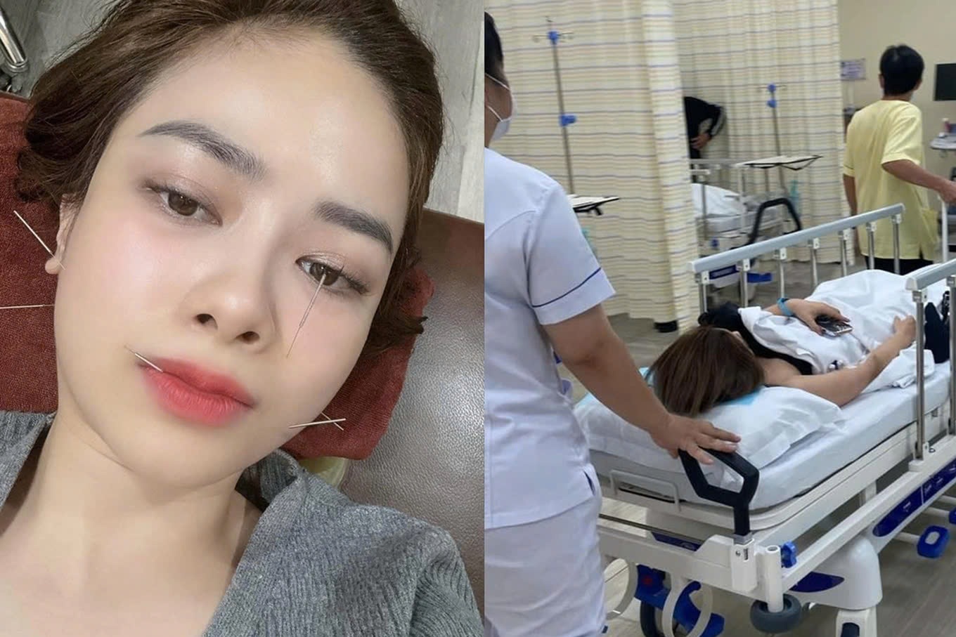 Dương Hoàng Yến bức xúc vì bị đồn qua đời sau khi liệt dây thần kinh số 7 - 2