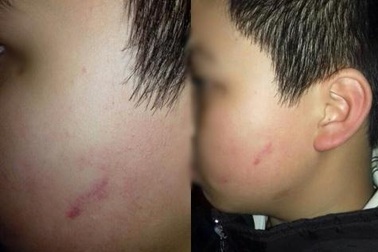 43 cái tát và "hội nghị Diên Hồng" về đại học