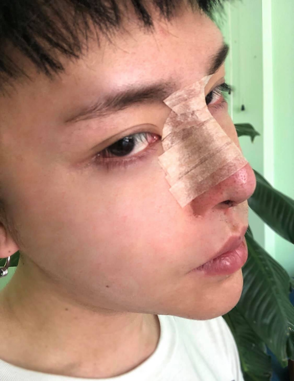 Chàng trai Đà Nẵng chi 1 tỷ đồng để sửa mặt phong thủy - 2 Chàng trai Đà Nẵng chi 1 tỷ đồng để sửa mặt phong thủy - 2